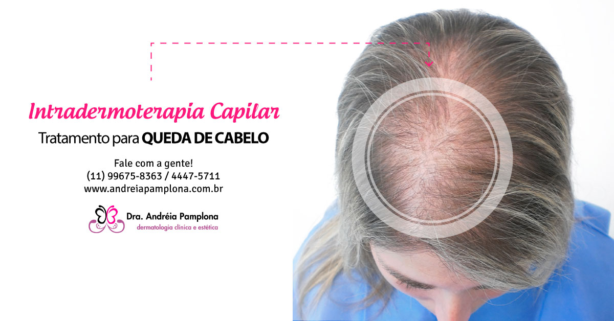 Intradermoterapia Capilar - Dra Andréia Pamplona