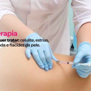 Carboxiterapia tratamento para; estrias, celulite, gordura localizada e flacidez da pele. Dra. Andréia Pamplona