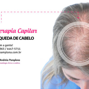 Intradermoterapia Capilar - Dra Andréia Pamplona
