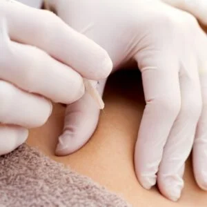 intradermoterapia dra andreia pamplona