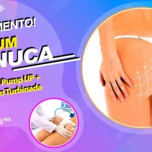PROJETO PUMPUP - Bumbum Na Nuca - Clínica Dra. andréia Pamplona
